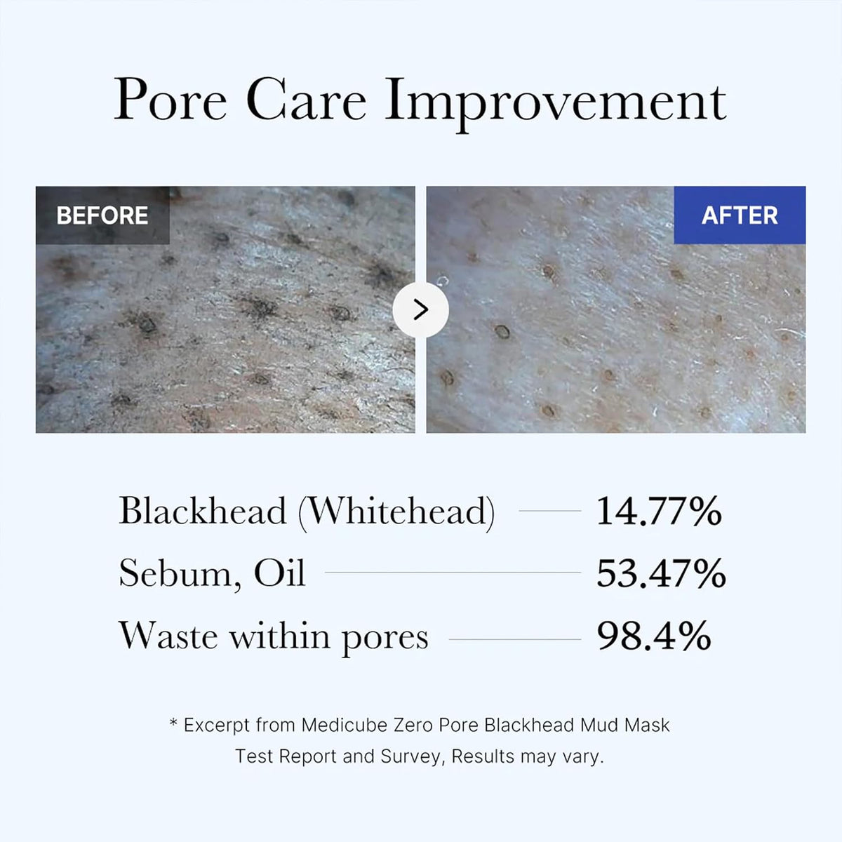 Zero Pore Blackhead Mud Mask – 3-Min Pore Cleanse