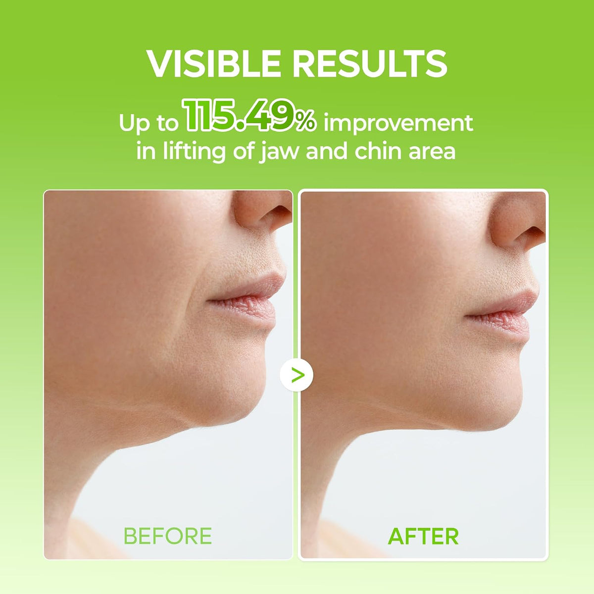 Cactox V-Lifting Mewing Band with Cactus Extract for Cooling, Puffiness Reduction, and Pore Tightening for Enhanced Skin Repair