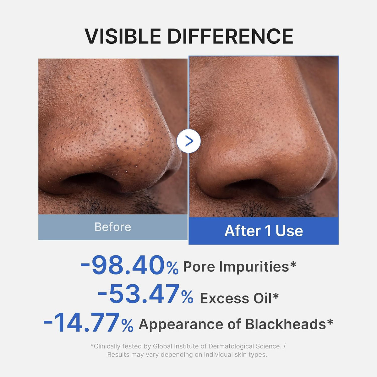 Zero Pore Blackhead Mud Mask - Cleansing and Gentle Exfoliation for Pore Care